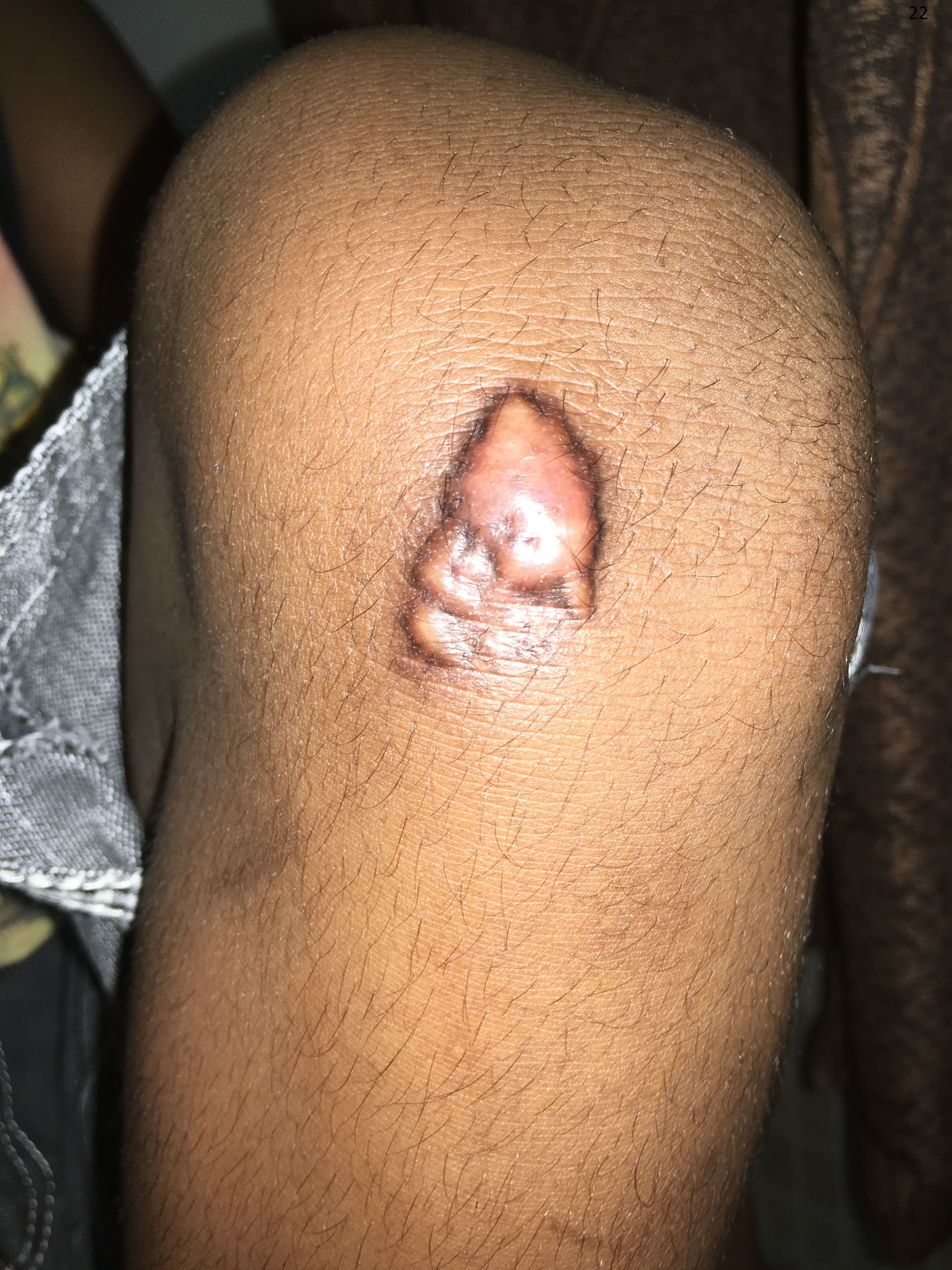 Pediatric Plastic Surgery Image 10